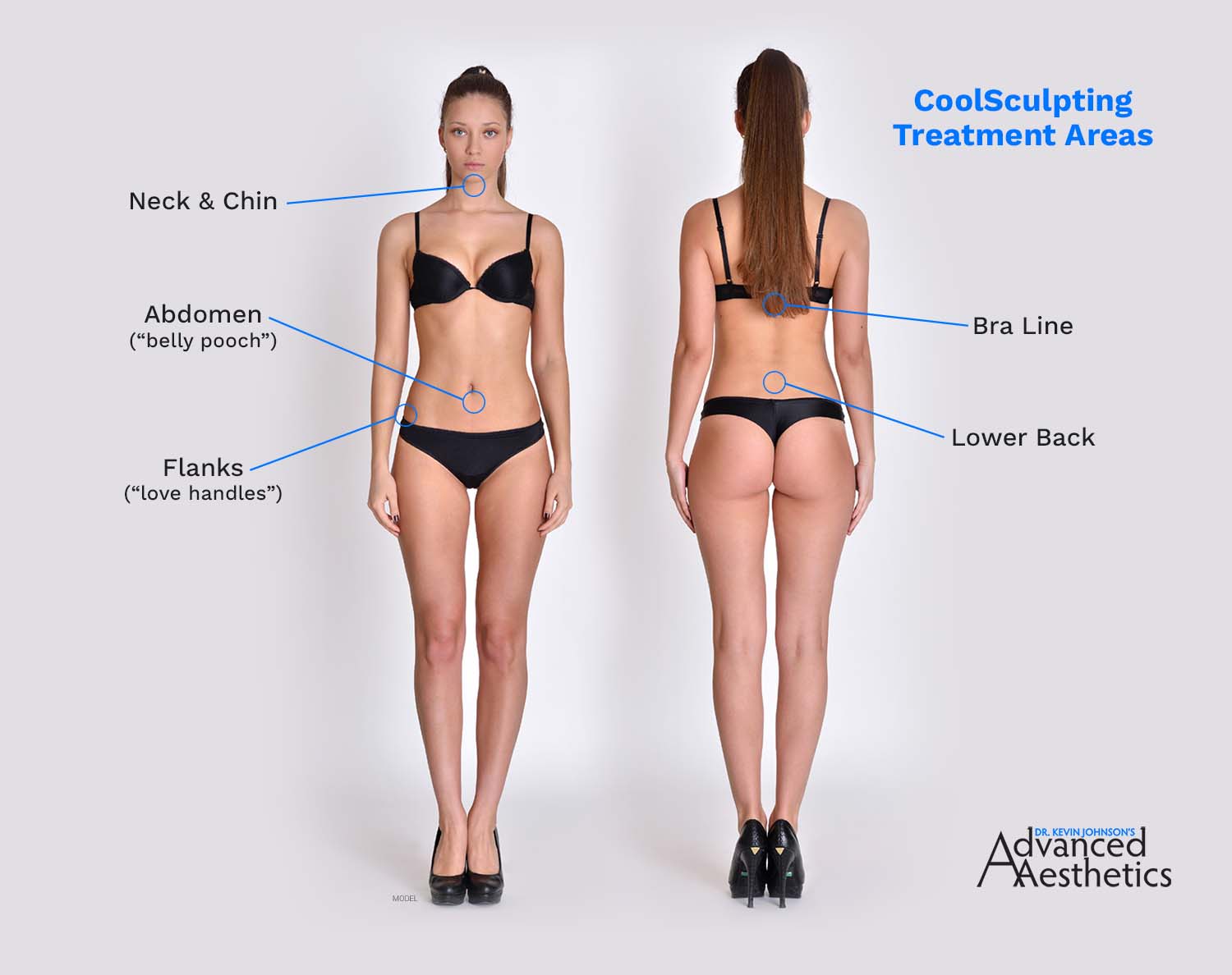 Smartlipo® Liposuction vs. CoolSculpting® – Dr. Kevin Johnson's